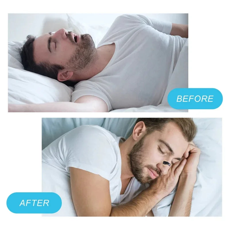 5/15/30days Magnetic Nasal Dilator Starter Kits Increase Air Intake Improve Sleeping Reduce Snoring Breathing Refill Nose Clip